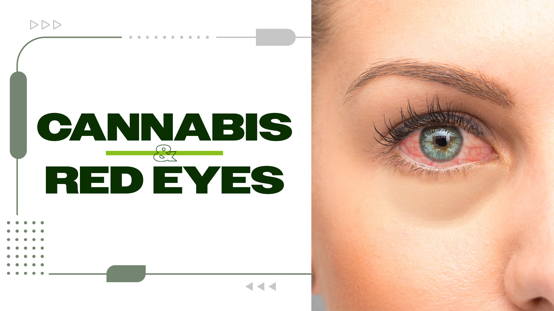 Why Does Weed Make Your Eyes Red?