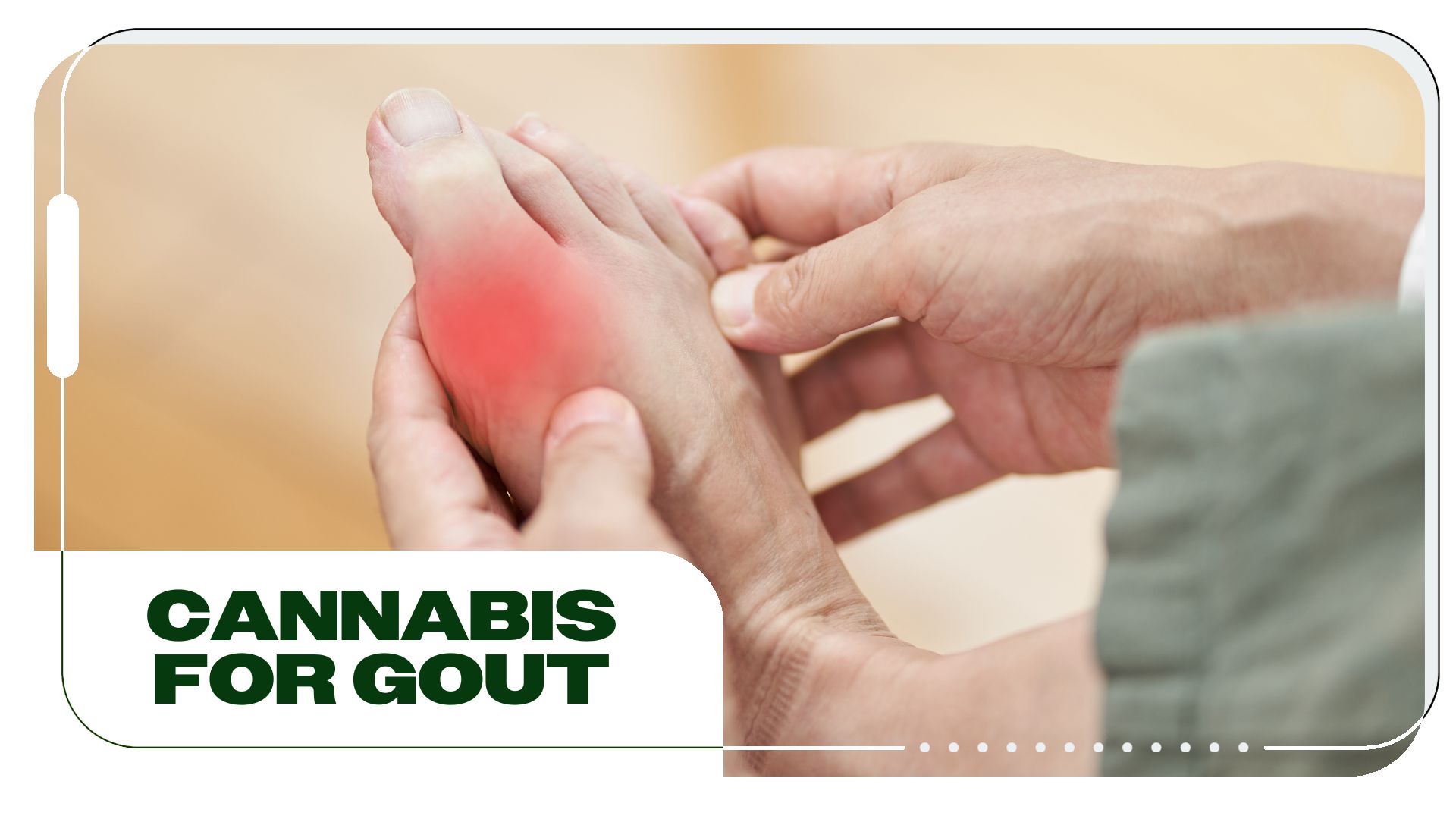 Using Cannabis to Help Treat the Excruciating Symptoms of Gout